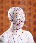 Acupuncture 101...What it is and how it works.
