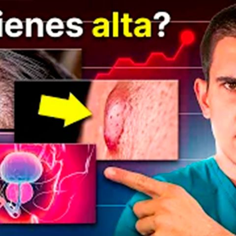 ¡Qué Ocurre en tu Cuerpo si tienes TESTOSTERONA ALTA!