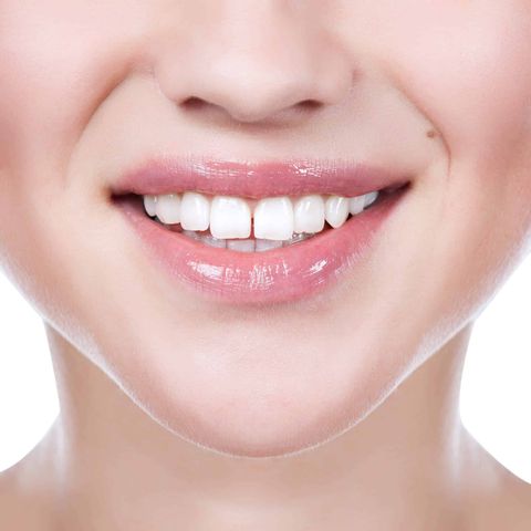 Dr Zhang Minguan | Treatments to Fix Teeth Gap