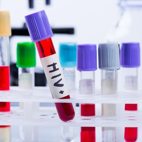 Heartland Newsfeed Radio Network: HIV prevention experts urge regular testing