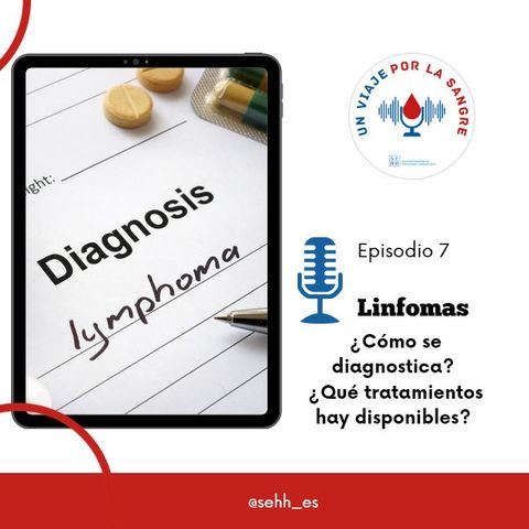 7. Los linfomas