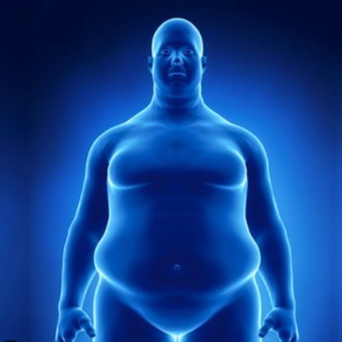 La Obesidad