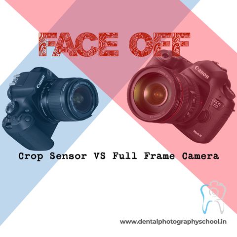 Crop sensor budget friendly or Full Frame expensive camera which is better for dental photography