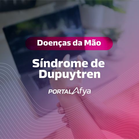 Podcast #131: Série doenças da mão: Síndrome de Dupuytren