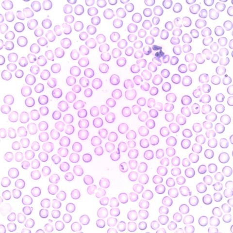 Acido Ipocloroso: La Potente Molecola del Sistema Immunitario al Servizio della Cura della Pelle