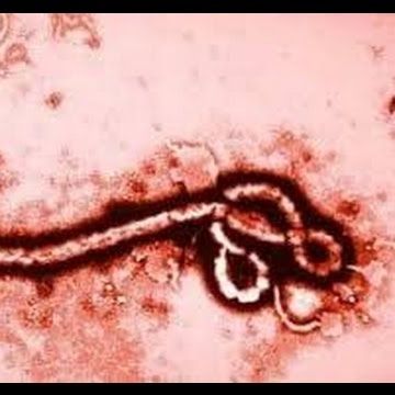 7-10-14 El Ébola en España #LaCafetera