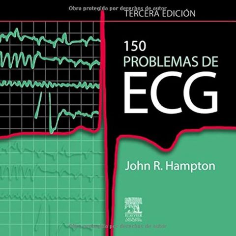 150 Problemas De Ecg