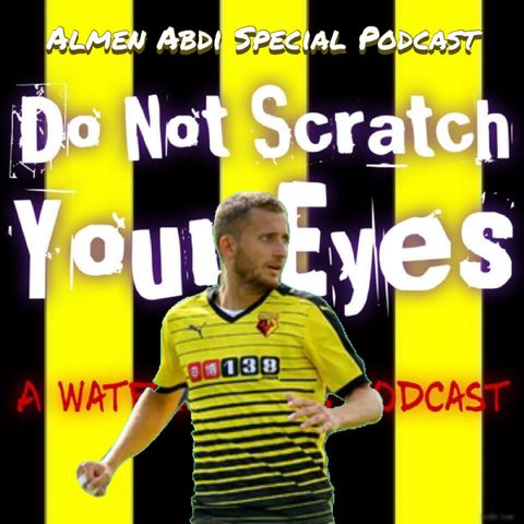 Do Not Scratch Your Eyes - Almen Abdi Special - S1 Ep31