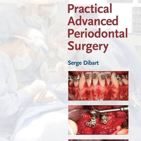 Practical Advanced Periodontal Surgery
