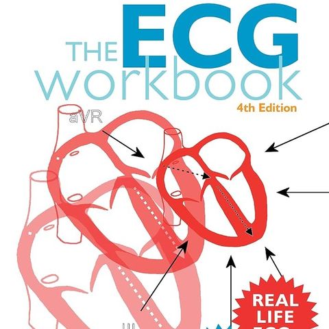 The ECG Workbook