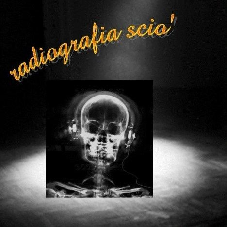Radiografia Scio' n.25BIS - LIVE - 12-13