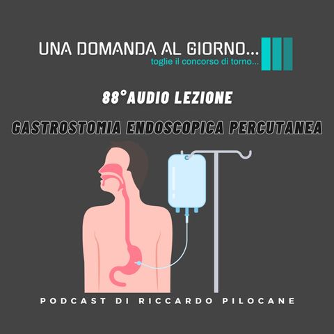 88° audio lezione Gastrostomia endoscopica percutanea (PEG)
