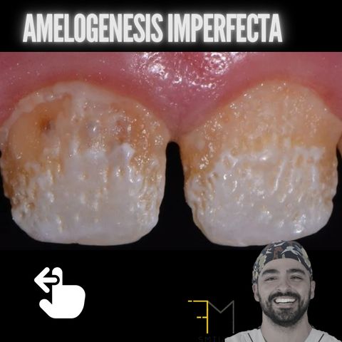 EP.9 Amelogenesis imperfecta, como reconocerla y como tratarla