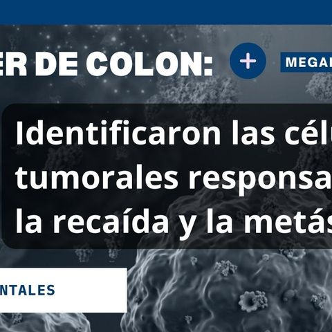 Identifican células de tumores responsables de recaídas y metástasis en Cáncer de colon Noti - Salud