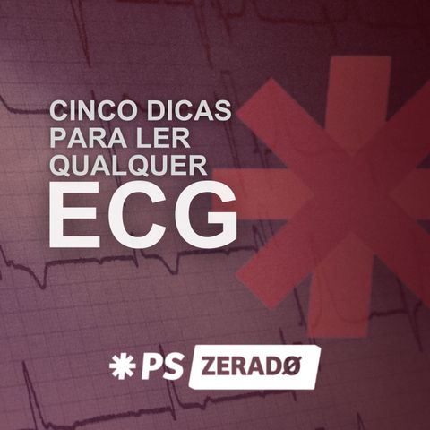 ECG Sem Mistérios: Dicas Práticas para Qualquer Situação