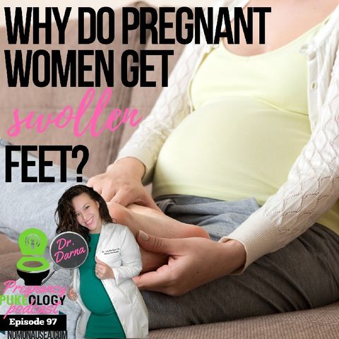 Why do pregnant women have swollen feet? Ep. 97 - Best Pregnancy Podcast Pukeology