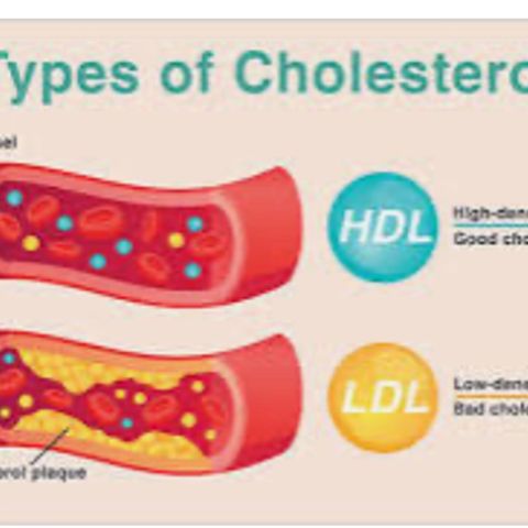 Cholesterol myths and internet misinformation - 6:23:24, 1.26 PM