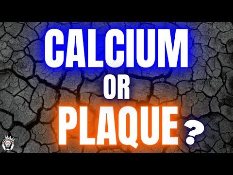 Does Heart Disease Develop from Calcium, or Plaque?