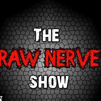 The Raw Nerve Show - 09-09-14
