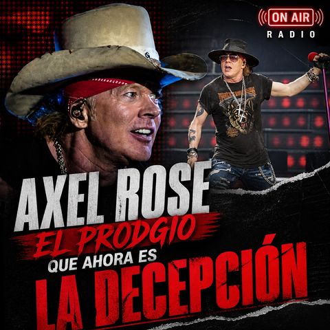 prodijo problema AXL ROSE