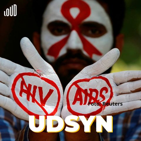 "Kampen mod HIV er endnu ikke vundet"