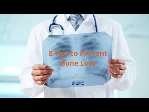 8 Tips to Prevent Bone Loss