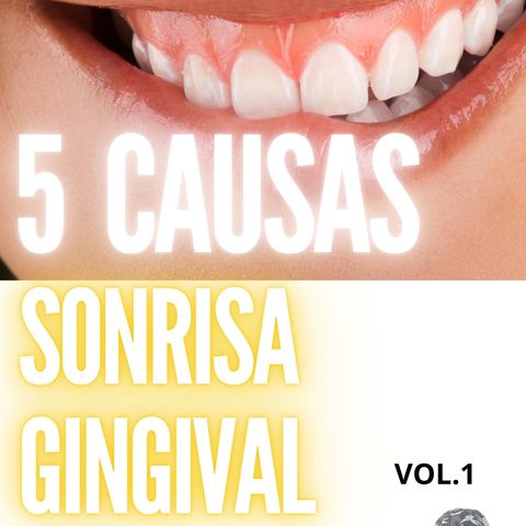 Ep. 11 - Las 5 Causas de la Sonrisa Gingival