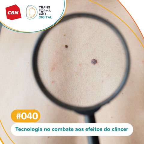 Transformação Digital CBN #40 - Tecnologia no combate aos efeitos do câncer de pele