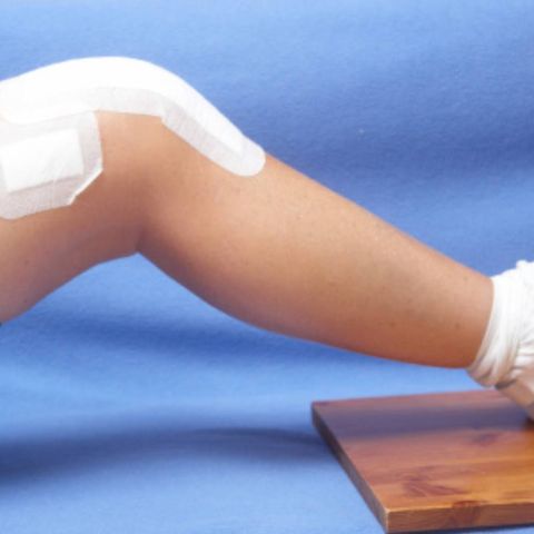 മുട്ടുമാറ്റിവയ്ക്കല്‍ ശസ്ത്രക്രിയ എങ്ങനെ എപ്പോള്‍?   |  Knee Replacement Surgery