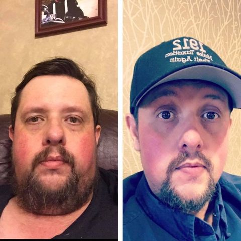 Losing 100 pounds On A Ketogenic Diet