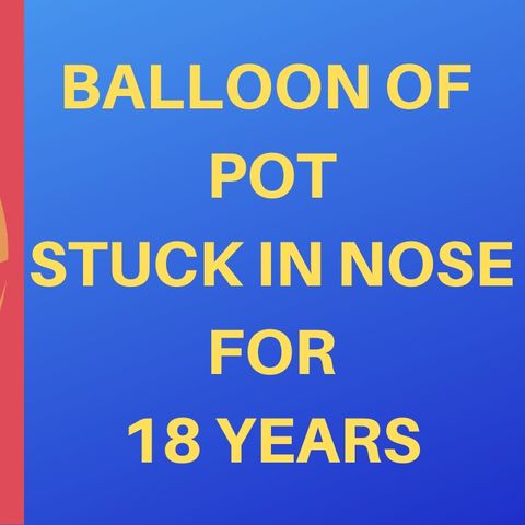 MAN HAS BALLOON OF POT UP HIS NOSE FOR 18 YEARS