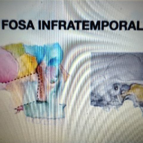 Fosa infratemporal