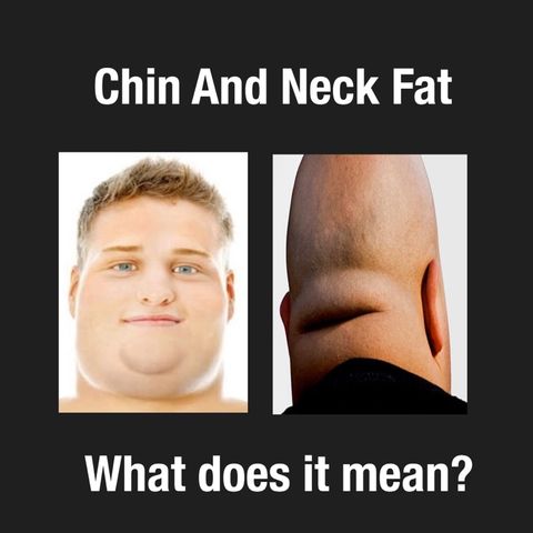 Episode 140 - Why Chin And Neck Fat Is So Deadly