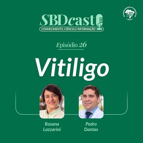 #T4E26 – Vitiligo