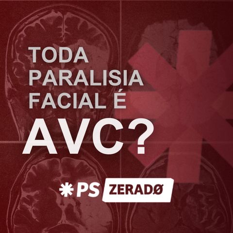 FluxoTammer: Toda Paralisia Facial é AVC?