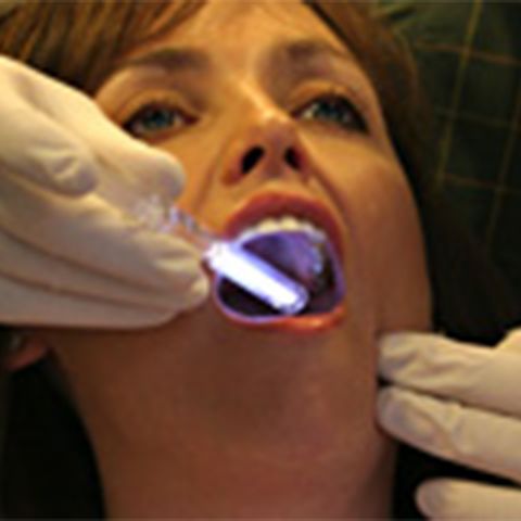 Vizilite Oral Cancer Screening