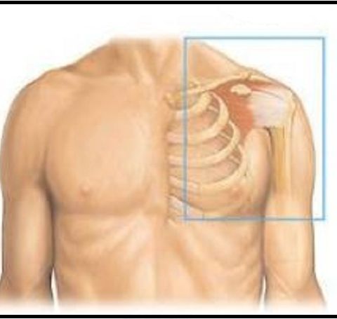 Il Dr. Stati ed il dolore cronico alla spalla