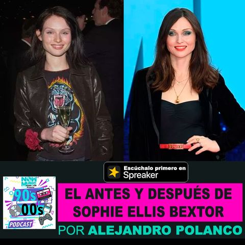 El Antes y Después de Sophie Ellis Bextor