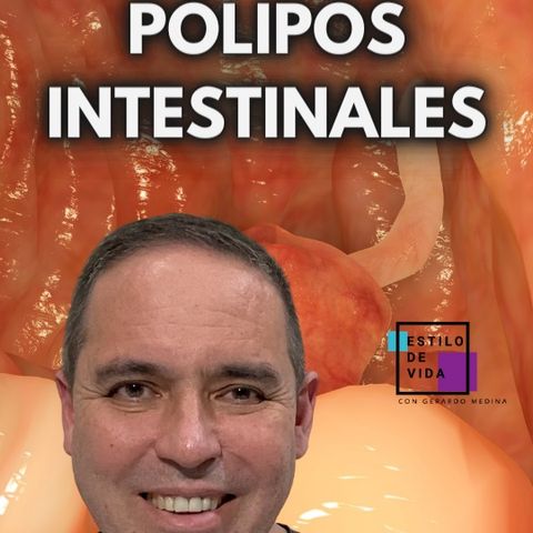 ▶️ ¿QUÉ SON LOS PÓLIPOS INTESTINALES?🧏🏻‍♀️ ✍🏼