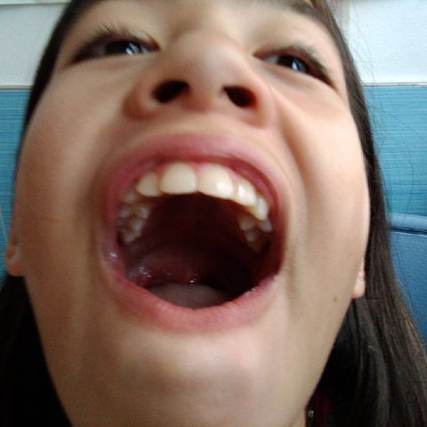 Chistes-Padma