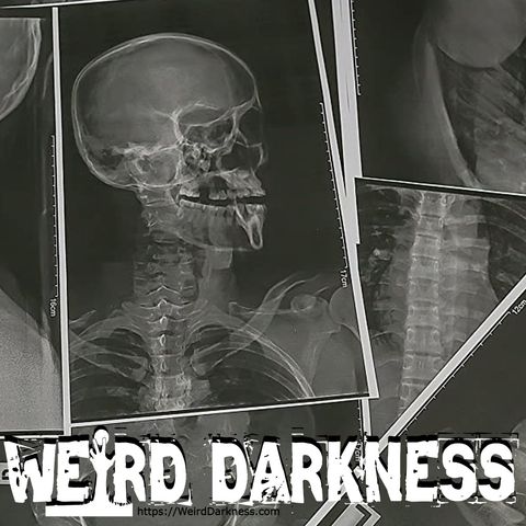 “FREAKY AND CREEPY MEDICAL CASES” #WeirdDarkness
