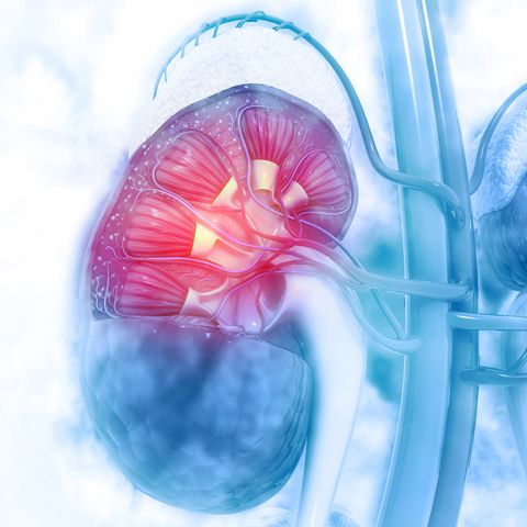 Predicting how childhood kidney cancers develop