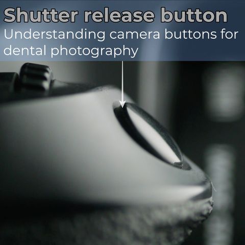 Shutter release Understanding camera buttons for dental photography