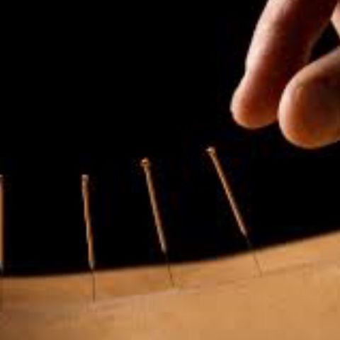 The Power of Acupuncture