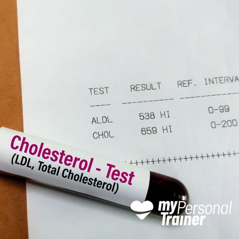 Colesterolo LDL: valori a rischio cardiovascolare