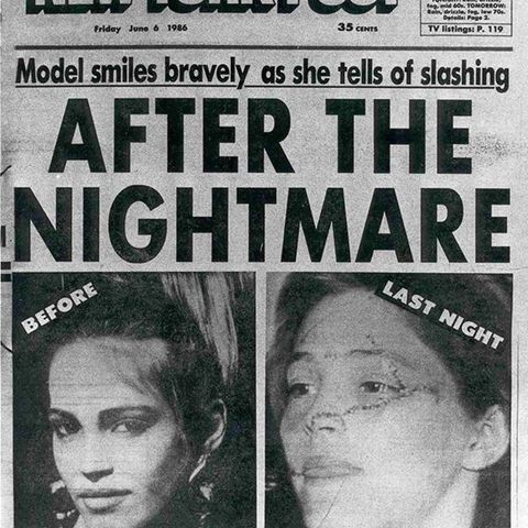 The Slashing of NYC Model Marla Hanson (1986) & NON-Creepy Surgical Charities