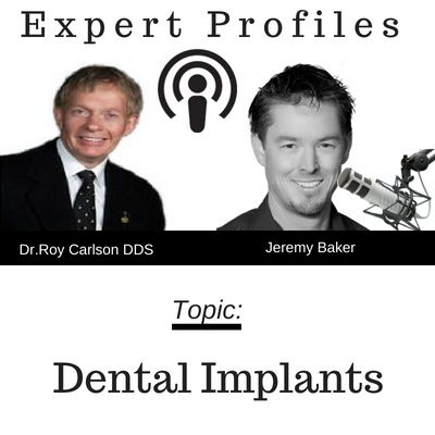 Dental Implant Q&A with Dr. Roy Carlson