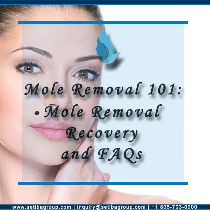 Mole Removal Recovery and FAQs