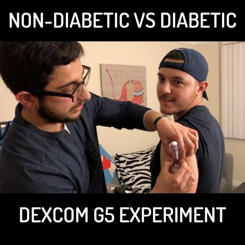 Non-Diabetic Wears Dexcom Experiment (Group Discussion Day 1)