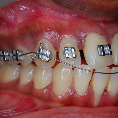 LasVegas Orthodontics